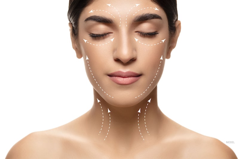 Why Sofwave is Revolutionizing Non-Surgical Facelifts