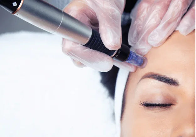 Why Variable Depth Matters in Microneedling — And What It Means for Your Skin
