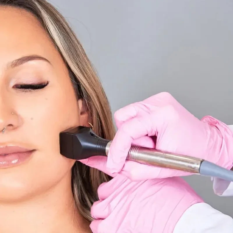 Lady having a treatment for skin tightening and lifting using Inmode Forma